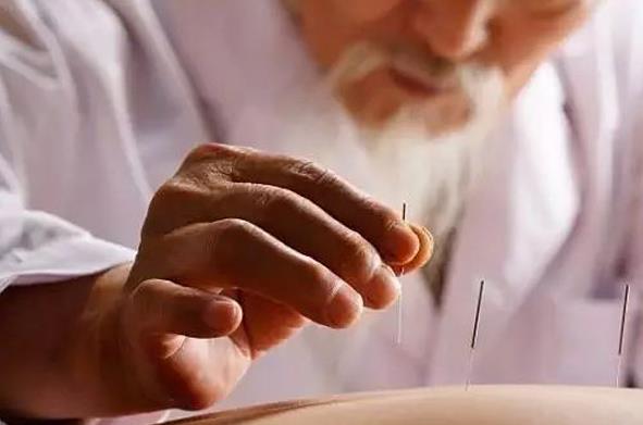 剖析针灸的三大功效及相关注意事项